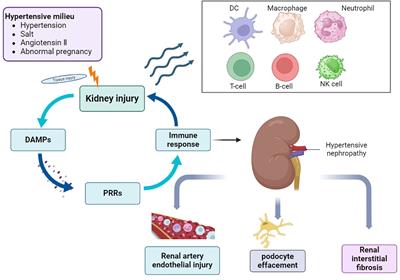 Mechanisms of inflammation modulation by different immune cells in hypertensive nephropathy